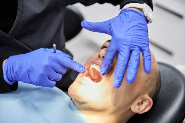 Best Emergency Broken Tooth Repair in Lowell, IN